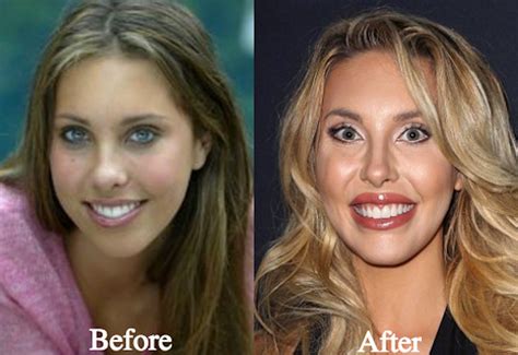 chloe latanzzi|chloe lattanzi before after.